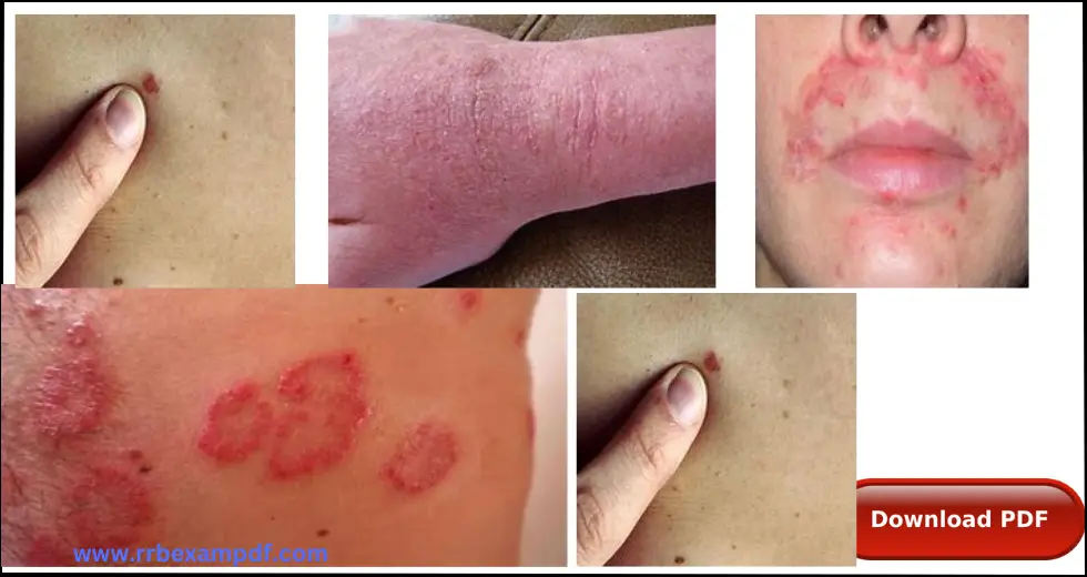 Skin Diseases List with Pictures PDF